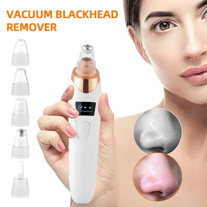 Electric Blackhead Remover & Pore Vacuum Cleaner