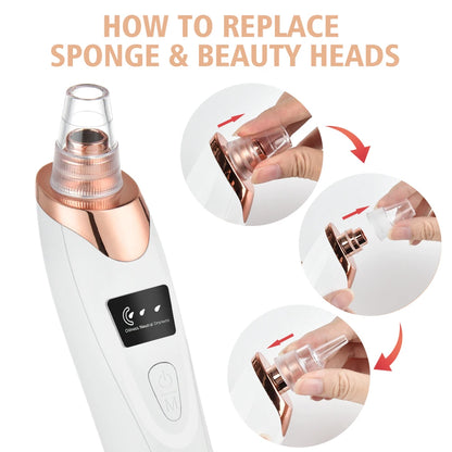 Electric Blackhead Remover & Pore Vacuum Cleaner