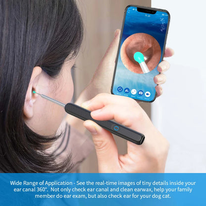 Ear Cleaner - Wireless Camera & LED Otoscope