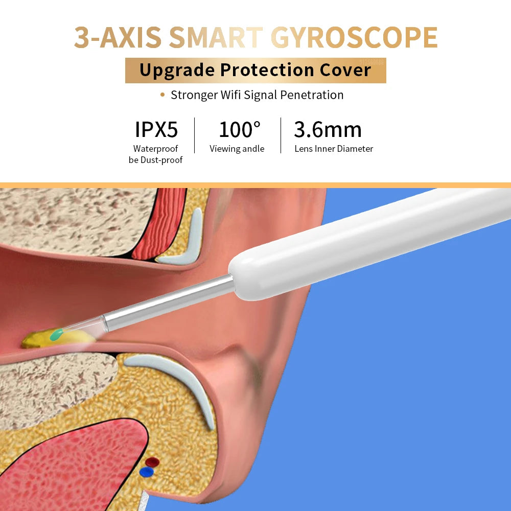 Ear Cleaner - Wireless Camera & LED Otoscope